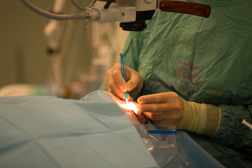 4 complicații care pot apărea după operația de cataractă
